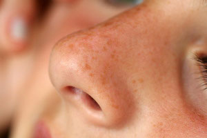 olfaction autisme hyposensibilité vêtements